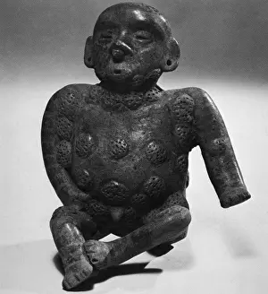 Syphilis: Figure Showing Syphilis Symptoms