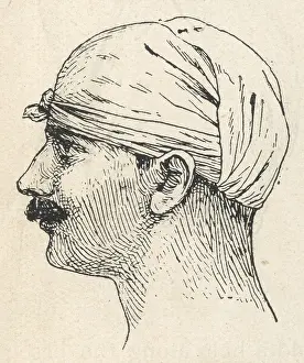 Scalp: First aid, bandaged head