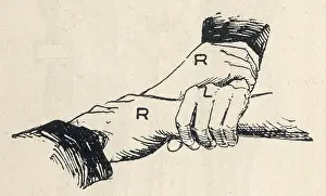 Interlocking: First aid, carrying patient using three interlocked hands