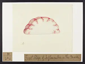 1826: First stage of inflammation in the brain