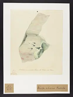 1827: Fistulous Communications between the Rectum and Uterus