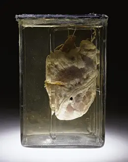 Forensic: Forensic Evidence, Heart Perforated by Bullet, 1937