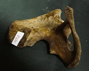 Disappeared: Forensic Evidence, Pelvis Bone