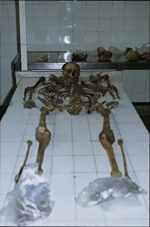 Disappeared: Forensic Evidence, Skeletal Reconstruction, 1985