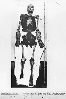 Murders: Forensic Evidence, Skeletal Reconstruction, Buck Ruxton Murd
