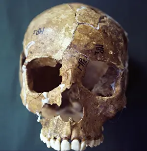 Disappeared: Forensic Evidence, Skull Reconstruction