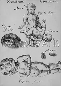 Disturbing: FREAK BIRTHS/GERMANY/C17