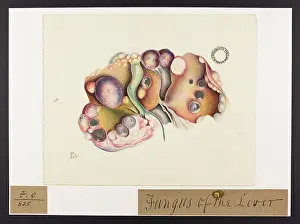 Liver: Fungus of Liver