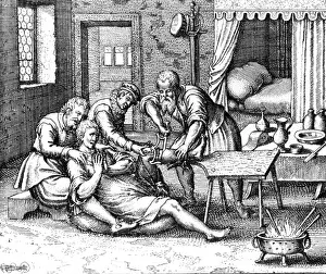 Sawing: Gangrene Amputation of Leg, 17th Century