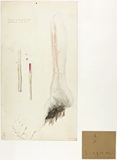 Ankle: Gangrene of the Ankle Joint