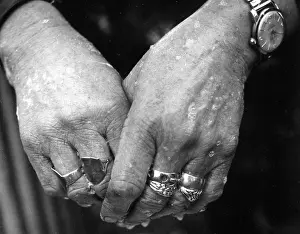 Blemishes: Gipsy woman's hands