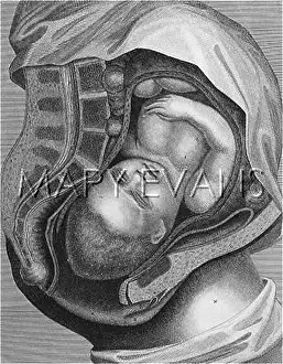 Parturition: GIVING BIRTH - 1ST STAGE