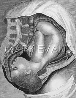 Parturition: GIVING BIRTH - 2ND STAGE