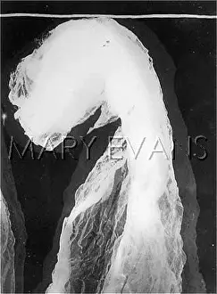 Ectoplasm: GOLIGHER ECTOPLASM