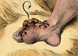 Gillray: The Gout