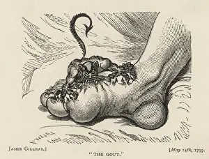 Sufferer: The Gout Devil Bites - 1799