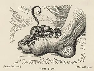 Sufferer: The Gout Devil Bites - 1799