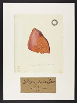 Liver: Granulated Liver