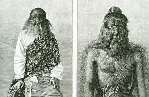 Hypertrichosis: HAIRY FOLK OF BURMA