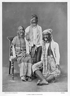 Hypertrichosis: HAIRY FOLK OF MANDALAY