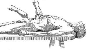 Preliminary: A Handbook of Morbid Anatomy and Post-Mortem Technique