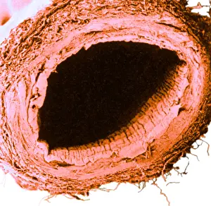 Microscopy: Healthy Vein, SEM