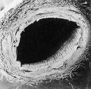 Microscopy: Healthy Vein, SEM