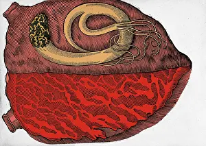 Cardiac: Heart with Parasite, 1639