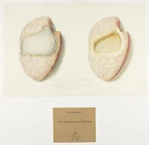 Hemisphere: Hemisphere: Cavity