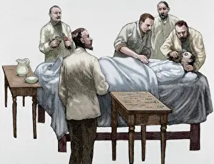 Medic: History of medicine. Chloroform anesthesia. Engraving, 19th