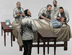 Medic: History of medicine. Chloroform anesthesia. Engraving, 19th