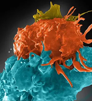 Causative: HIV-Infected and Normal T Cells Interact, FIB-SEM