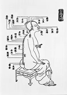 Acupuncture: Human figure shown in right profile with ?