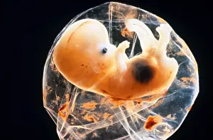 Sauk: Human foetus, 5 - 6 weeks