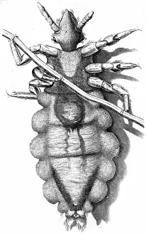 Microscope: Human Louse, a wingless parasitic insect. Engraving