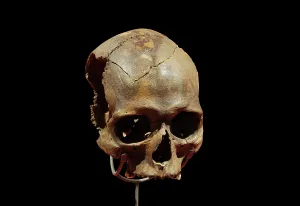 Vindolanda: Human skull, Vindolanda Museum, Hadrian's Wall