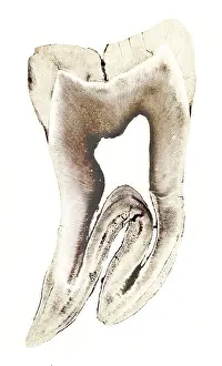 Micrograph: Human Tooth, Early Photomicrograph