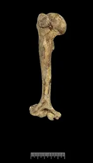 Humerus: Humerus of Achondroplastic Dwarf