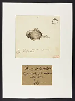 Gall: Hypertrophy of the Reticular Structure of the Gall Bladder