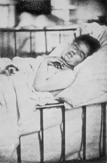 Contraction: Hysterical Mental - 1876