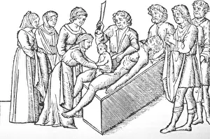 Midwives: Illustration of the birth of Julius Caesar, ?