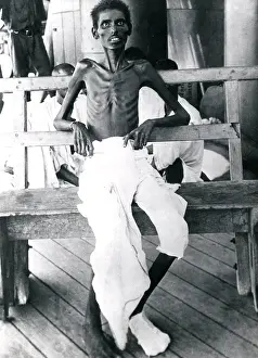 Ribs: Indian soldier after the Siege of Kut, WW1