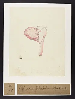 Barker: Inflammation of the Cerebellum & Spinal Cord