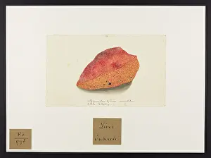 Accumulation: Inflammation of Liver