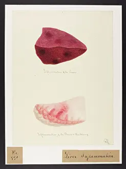 Liver: Inflammation of Liver, Brain and Membranes