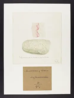 Flagg: Inflammation of the Membranes of the Brain