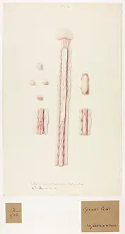 Blank: Inflammation, Softening and Suppuration of Spinal Cord