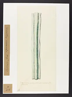 Cord: Inflammation and Suppuration of the spinal cord