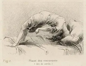 Contortions: Insanity - Hysteria - 1881