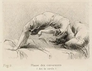 Insanity: Insanity - Hysteria - 1881